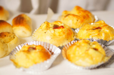 後頭部が禿げた