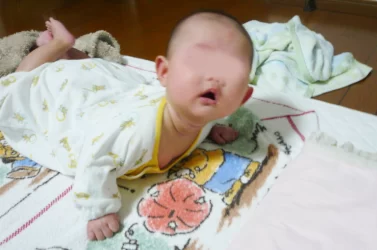 生後3ヶ月　首が持ち上がる