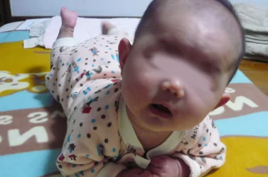 3、4ヶ月健診（BCG）へ行きました