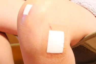 大きく膝を擦りむいたときの対処方法